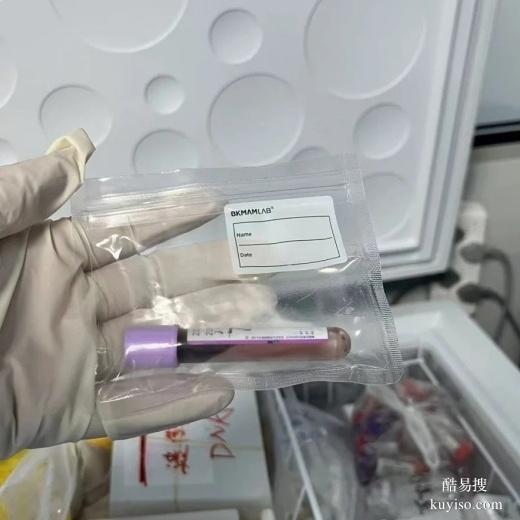 臺州在本地做了兩次孕期親子鑒定-2025鑒定流程攻略