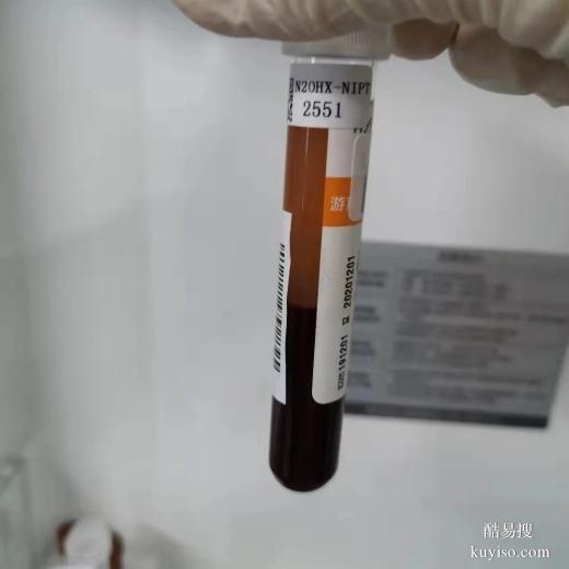 臺州孕期如何不被發(fā)現做親子鑒定-2025鑒定機構名單