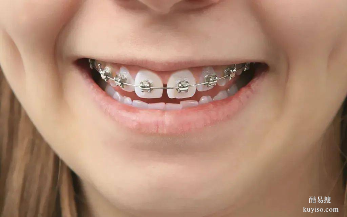家长注意：孩子牙齿矫正的黄金时间节点